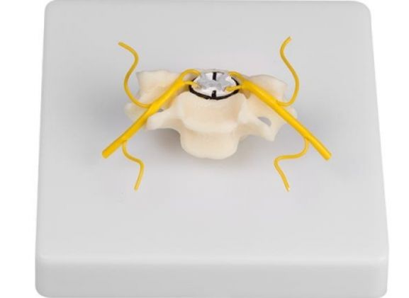 https://www.jayakelana.id/uploads/product/-4067-vertebra-with-spinal-952539f2afe432b_cover.jpg