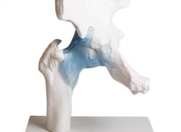 https://www.jayakelana.id/uploads/product/-4553-hip-joint-with-82763c414e2056d_cover.jpg