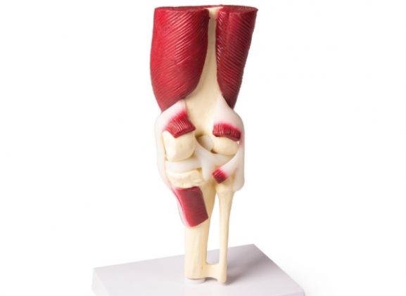 https://www.jayakelana.id/uploads/product/-4662-knee-joint-life-8299968e157feef_cover.jpg
