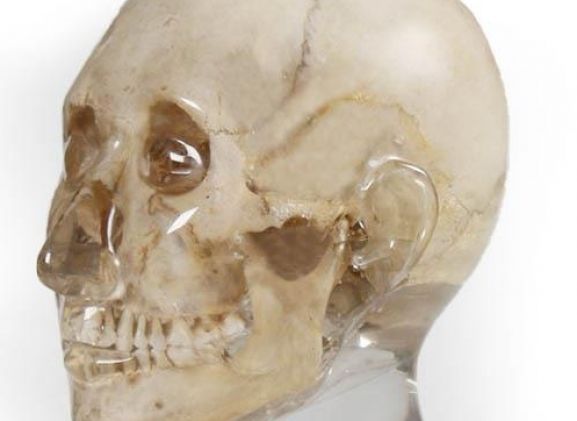 https://www.jayakelana.id/uploads/product/-7320-x-ray-phantom-head--9158351c6a21c55_cover.jpg