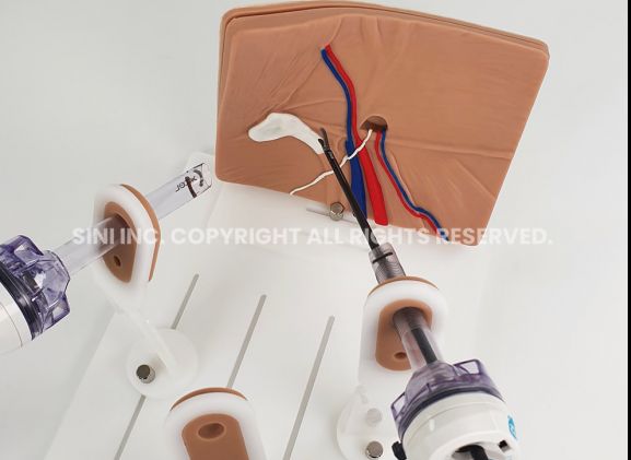 https://www.jayakelana.id/uploads/product/-a-lph-01-laparoscopic-hernia-surgery-7117416c2979294_cover.jpg