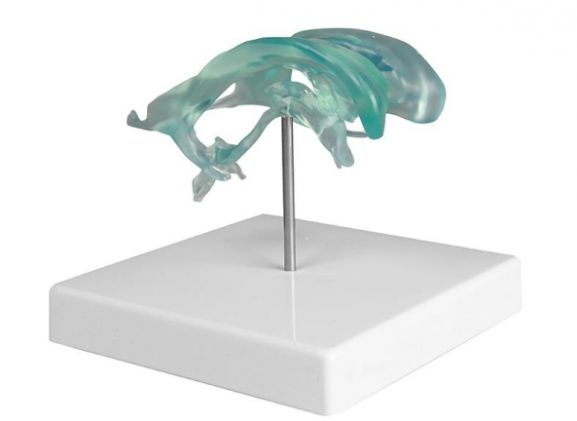 https://www.jayakelana.id/uploads/product/-c263-brain-ventricle-99838bf2f301075_cover.jpg