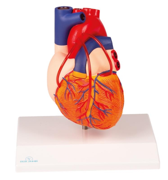 (G205) Heart with Bypass