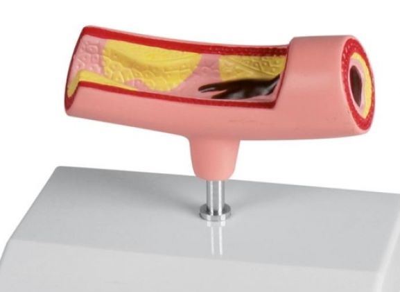 https://www.jayakelana.id/uploads/product/-g241-artery-model-772495449e734f5_cover.jpg