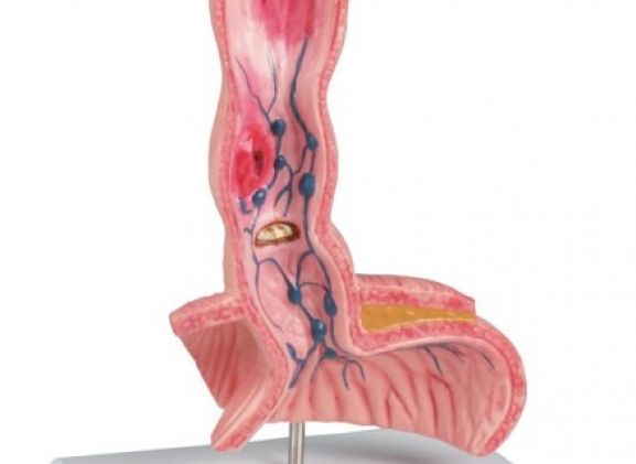 https://www.jayakelana.id/uploads/product/-k218-oesophagus-diseases-91822f04ad01eaf_cover.jpg