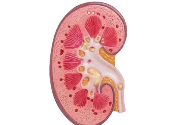 https://www.jayakelana.id/uploads/product/-k229-kidney-stone-model-18398e383d2b92e_cover.jpg