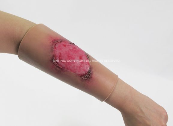 https://www.jayakelana.id/uploads/product/-l-bur-01-burn-treatment-model-30229ee7a54c9c5_cover.jpg