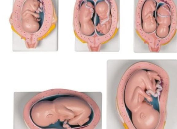 https://www.jayakelana.id/uploads/product/-l204-pregnancy-model-set--3240079c3983ebe_cover.jpg
