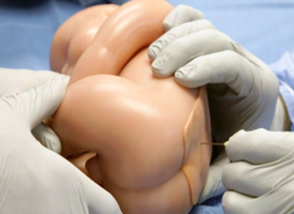 https://www.jayakelana.id/uploads/product/-lpb-40-lumbar-puncture-baby-752626142266041_cover.png