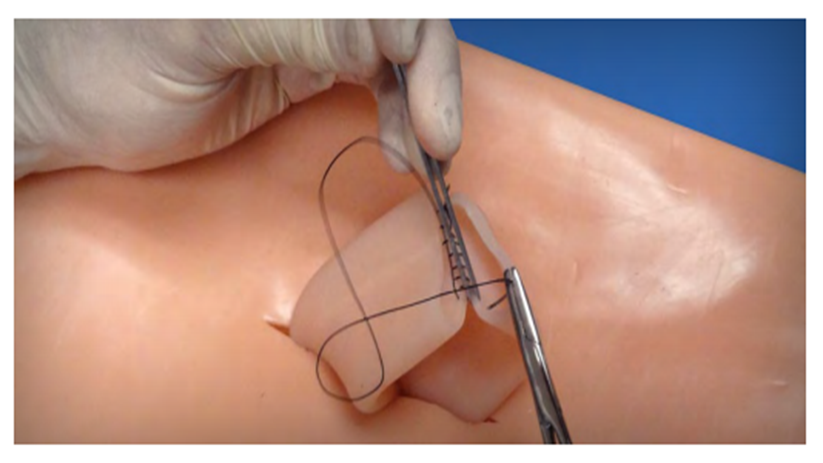 (LPMT-10) LAPAROTOMY REPLACEABLE TISSUE 