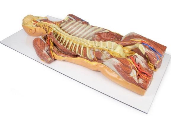 https://www.jayakelana.id/uploads/product/-mp1410-posterior-body-wall-69323ffc8cd80b2_cover.jpg