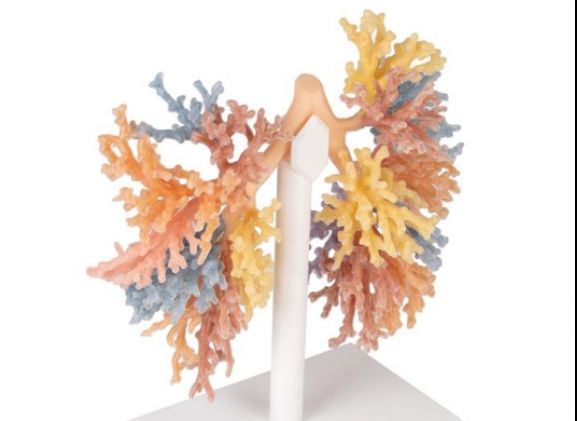 https://www.jayakelana.id/uploads/product/-mp1690-bronchial-tree-243324f35a34dc6_cover.jpg
