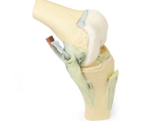 https://www.jayakelana.id/uploads/product/-mp1800-knee-joint-flexed-89418a7b40730c5_cover.jpg