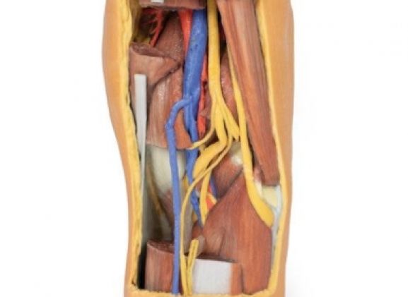 https://www.jayakelana.id/uploads/product/-mp1820-popliteal-fossa-distal-7454066ff46504e_cover.jpg
