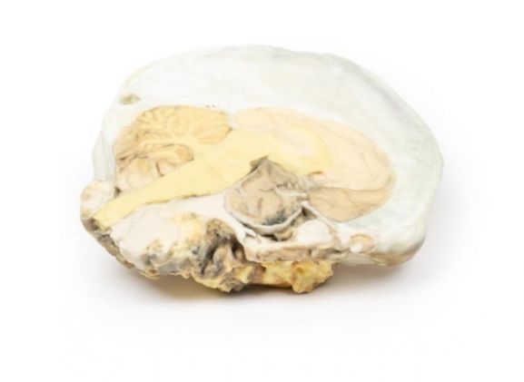 https://www.jayakelana.id/uploads/product/-mp2006-pituitary-adenoma-24584e7d9ff5b59_cover.jpg