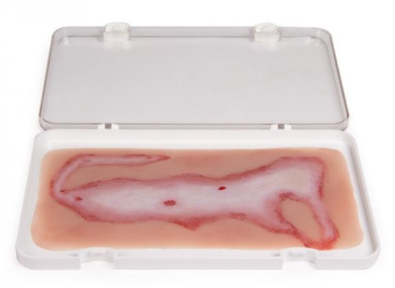 https://www.jayakelana.id/uploads/product/-nw108-wound-moulage-scalding-878556fa9e7b542_cover.jpg