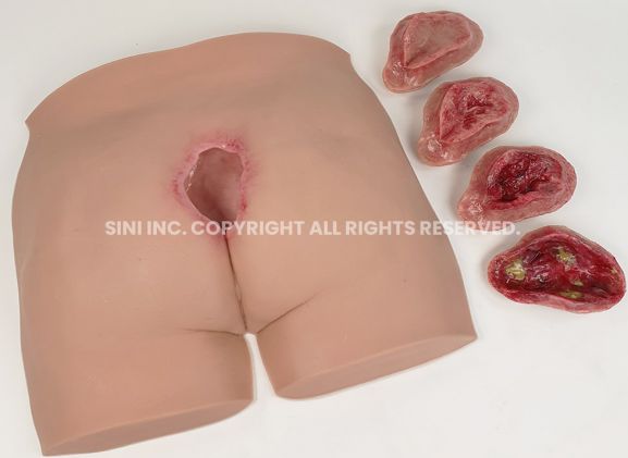 https://www.jayakelana.id/uploads/product/-p-deu-01-decubitus-ulcer-trainer-36706786ebaa4b7_cover.jpg