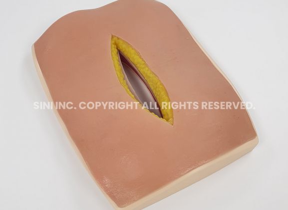https://www.jayakelana.id/uploads/product/-s-afs-01-abdominal-fascia-suture-968431c7eb30eca_cover.jpg