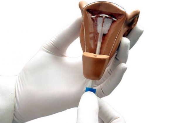 https://www.jayakelana.id/uploads/product/uterus-i-iud-placement-64463ffb81dc10c_cover.png