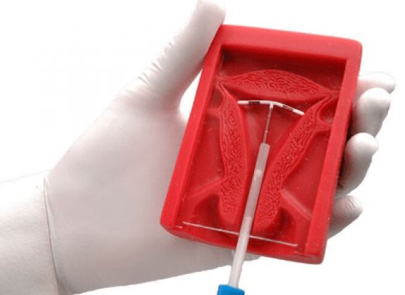 https://www.jayakelana.id/uploads/product/uterus-ii-iud-placement-13744b31b02c2be_cover.png